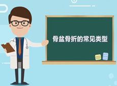 【醫療科普】骨盆骨折的常見類型有哪幾種?