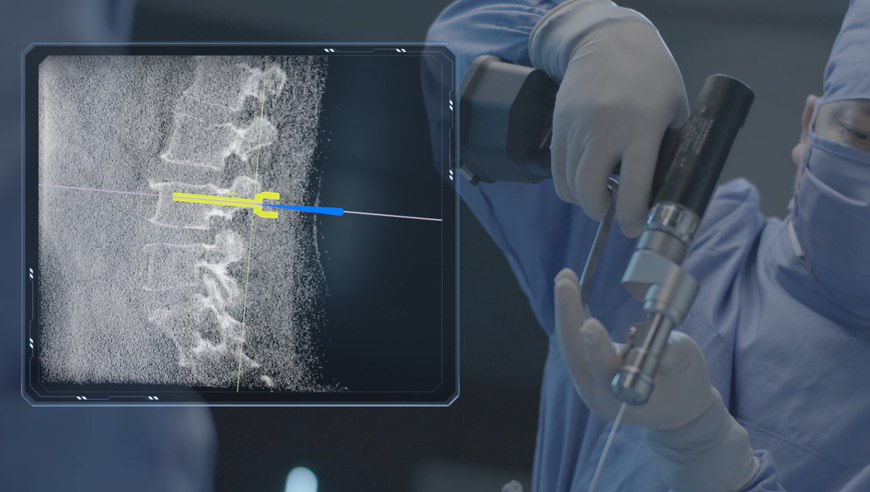 機(jī)器人做手術(shù)好還是醫(yī)生做手術(shù)好,機(jī)器人做手術(shù)有哪些好處?