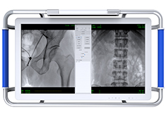 C臂機的圖像質量越用越差? 原因可能是球管的衰減