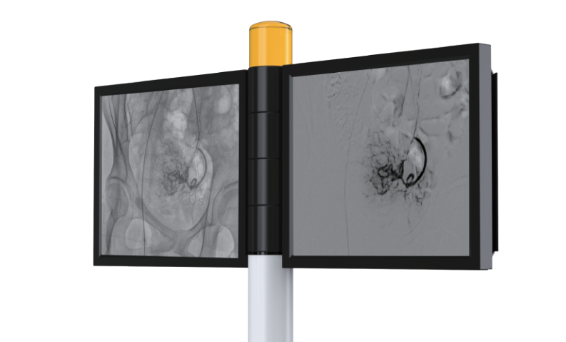 PLX7100A介入C形臂顯示器 PLX7100A介入C形臂顯示器