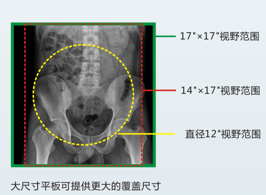 動態DR成像視野 動態DR成像視野