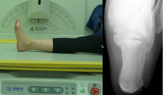 多功能動態DR 多功能動態DR