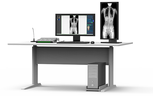 動態(tài)DR機大視野成像 動態(tài)DR機大視野成像