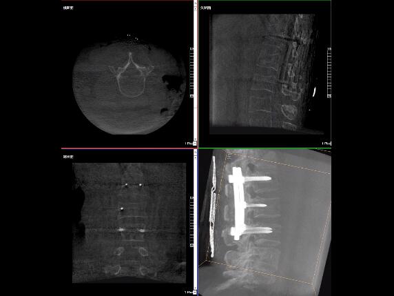 【醫療科普】2分鐘帶你了解高質量X光片的標準是什么? 【醫療科普】2分鐘帶你了解高質量X光片的標準是什么?