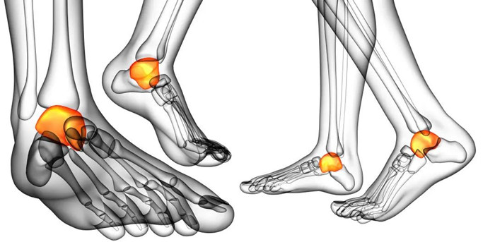 【醫療科普】三維影像可以清楚地看到關節面 【醫療科普】三維影像可以清楚地看到關節面