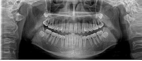 全景機影像 全景機影像