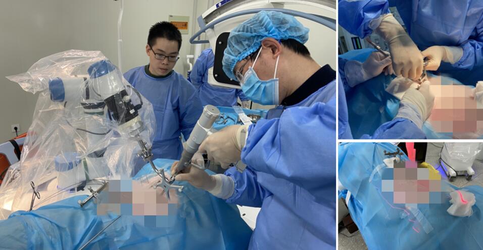 骨科手術機器人手術創面小 骨科手術機器人手術創面小