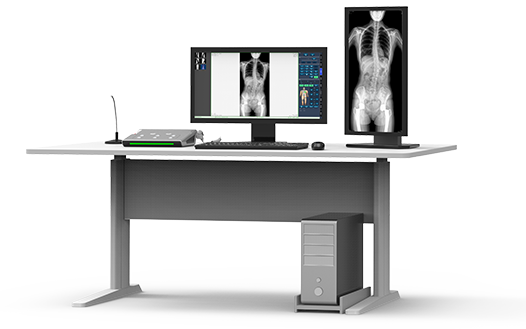 大視野平板動(dòng)態(tài)DR全脊柱一次成像 大視野平板動(dòng)態(tài)DR全脊柱一次成像