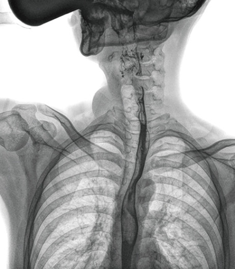 動態DR上消化道造影 動態DR上消化道造影