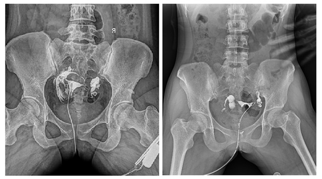 動態DR造影 動態DR造影