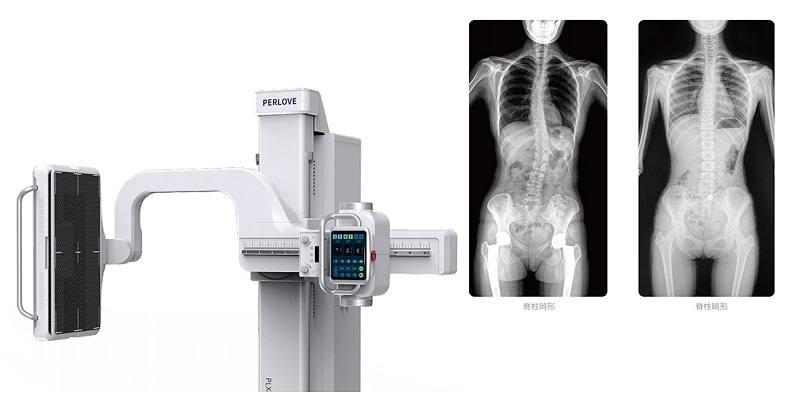 動態DR脊柱拍片